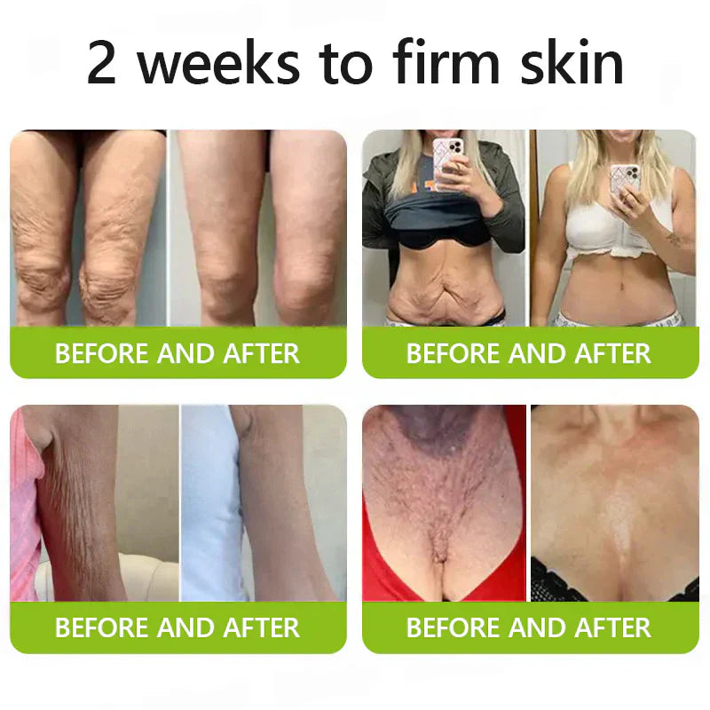 Gewinnen Sie jetzt jugendliche Haut zurück💫BOTOX & VITA A RETINOL SHOT Faltenglättende Straffungscreme