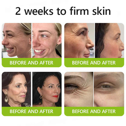 Gewinnen Sie jetzt jugendliche Haut zurück💫BOTOX & VITA A RETINOL SHOT Faltenglättende Straffungscreme